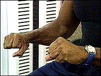 Chemical stops stroke damage