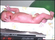 Small birthweight and premature births associated with higher risk of child abuse