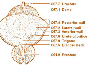 BLADDER CANCER