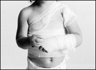 Back-Over Injuries to Children Greater with Trucks, Minivans