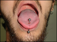 Tongue Piercing May Cause Gapped Teeth