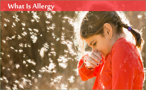 What Is Allergy?