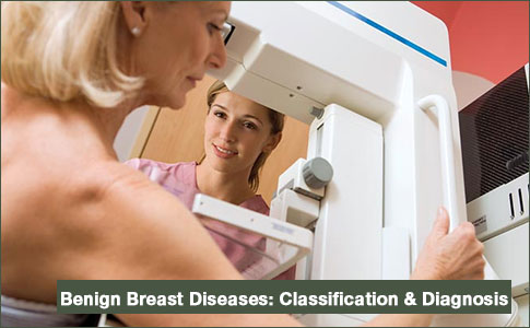 Benign Breast Diseases: Classification, Diagnosis, and Management