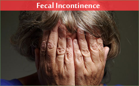 What is Fecal Incontinence