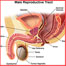 Carcinoma of the Urethra