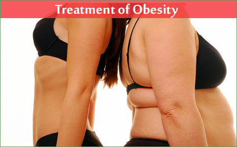 Treatment of Obesity