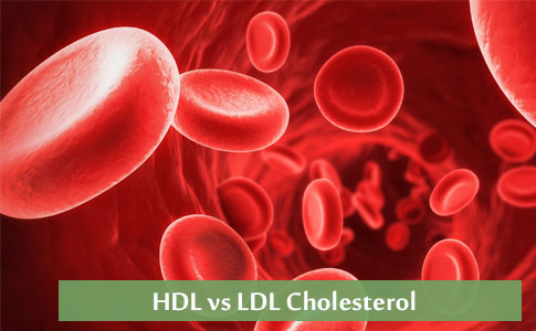 High Blood cholesterol - Overview, Causes