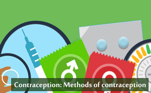 Contraception - Methods of contraception